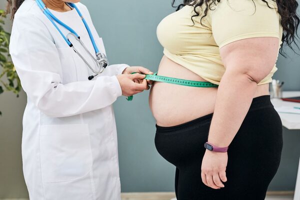 Obesidad en Yucatán supera cifras de todo 2024