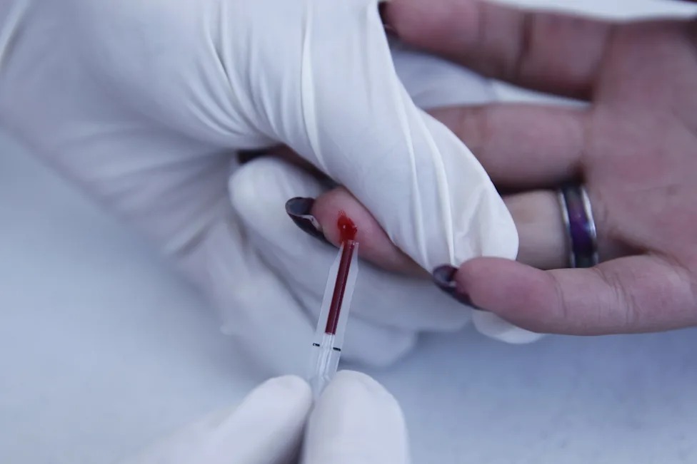 Hepatitis C puede curarse en hasta 95 % de casos, pero miles de mexicanos la desconocen
