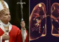 Papa León XIV es operado con éxito de cáncer pulmonar